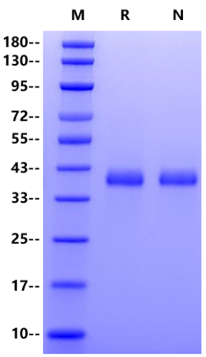 FGL2 His Tag Protein, Mouse