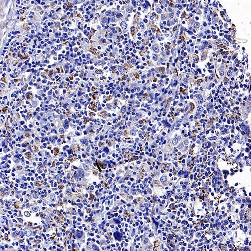 SOD2/MnSOD (acetyl K68) Rabbit Polyclonal Antibody