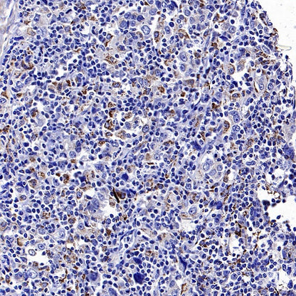 SOD2/MnSOD (acetyl K68) Rabbit Polyclonal Antibody