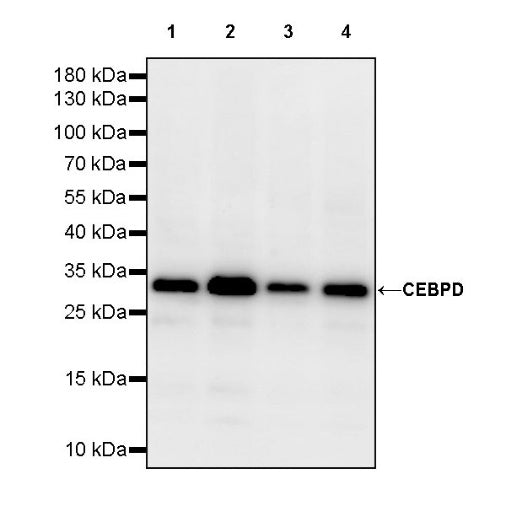 CEBPD Recombinant Rabbit mAb (S-1932-47)
