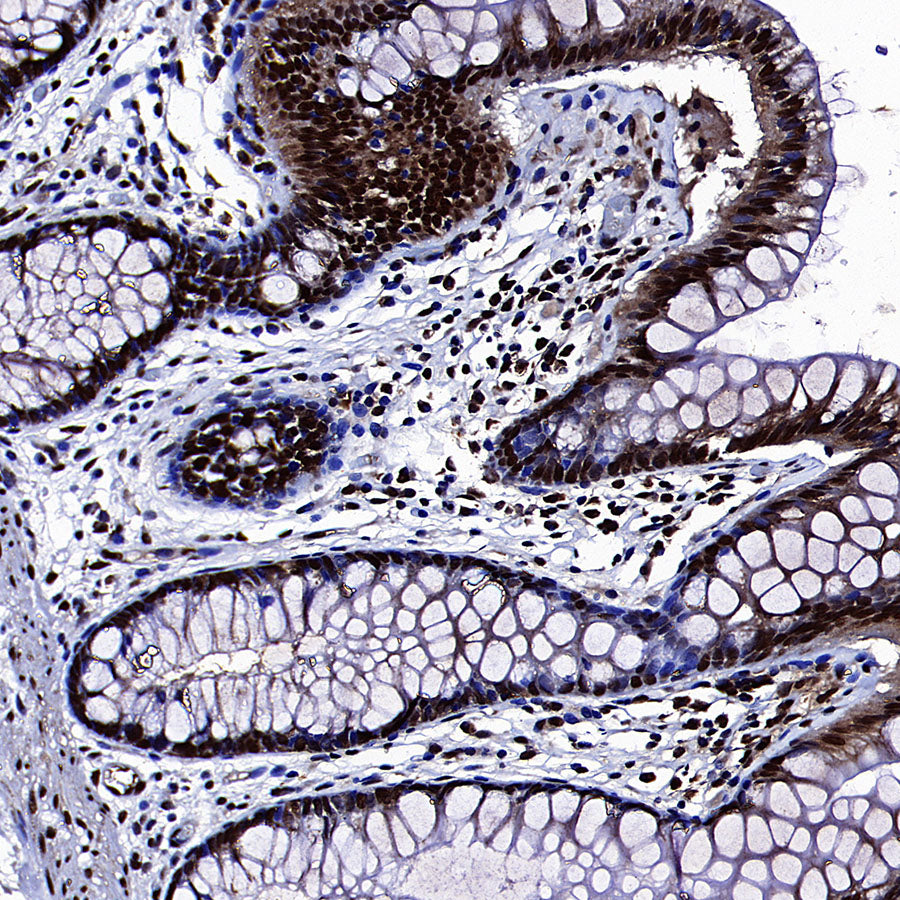 SAE1 Rabbit Polyclonal Antibody