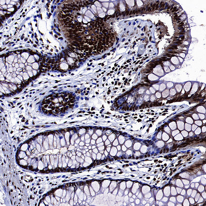 SAE1 Rabbit Polyclonal Antibody