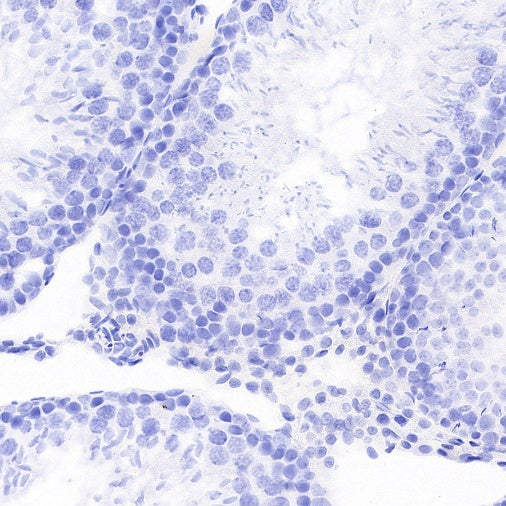 STEAP3 Recombinant Rabbit mAb (S-4466-26)