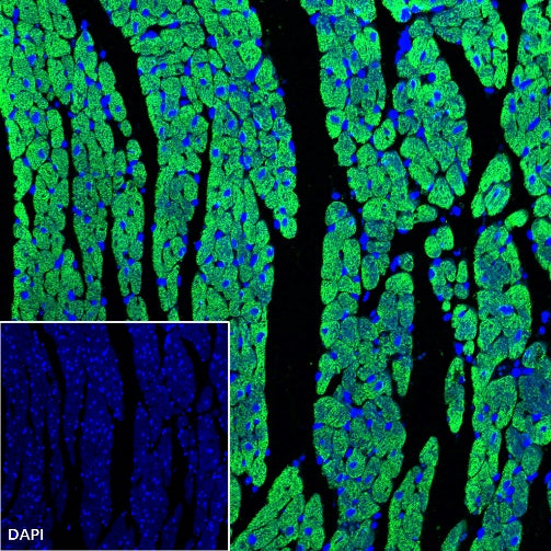 Myosin Light Chain 2/MLC-2V Rabbit Polyclonal Antibody