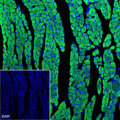 Myosin Light Chain 2/MLC-2V Rabbit Polyclonal Antibody