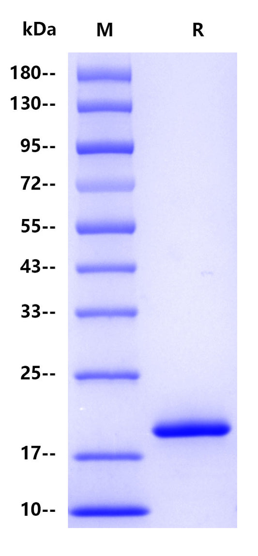 IFN-alpha1 His Tag Protein, Human