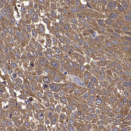 LDHB Rabbit Polyclonal Antibody