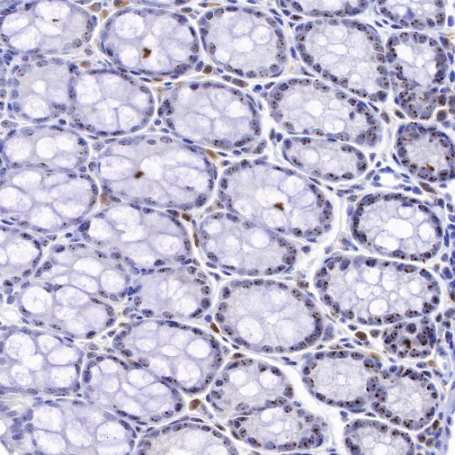 Nucleophosmin/NPM Recombinant Rabbit mAb (S-R231)
