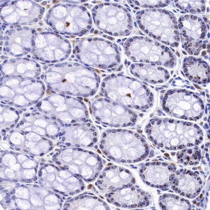 Nucleophosmin/NPM Recombinant Rabbit mAb (S-R231)
