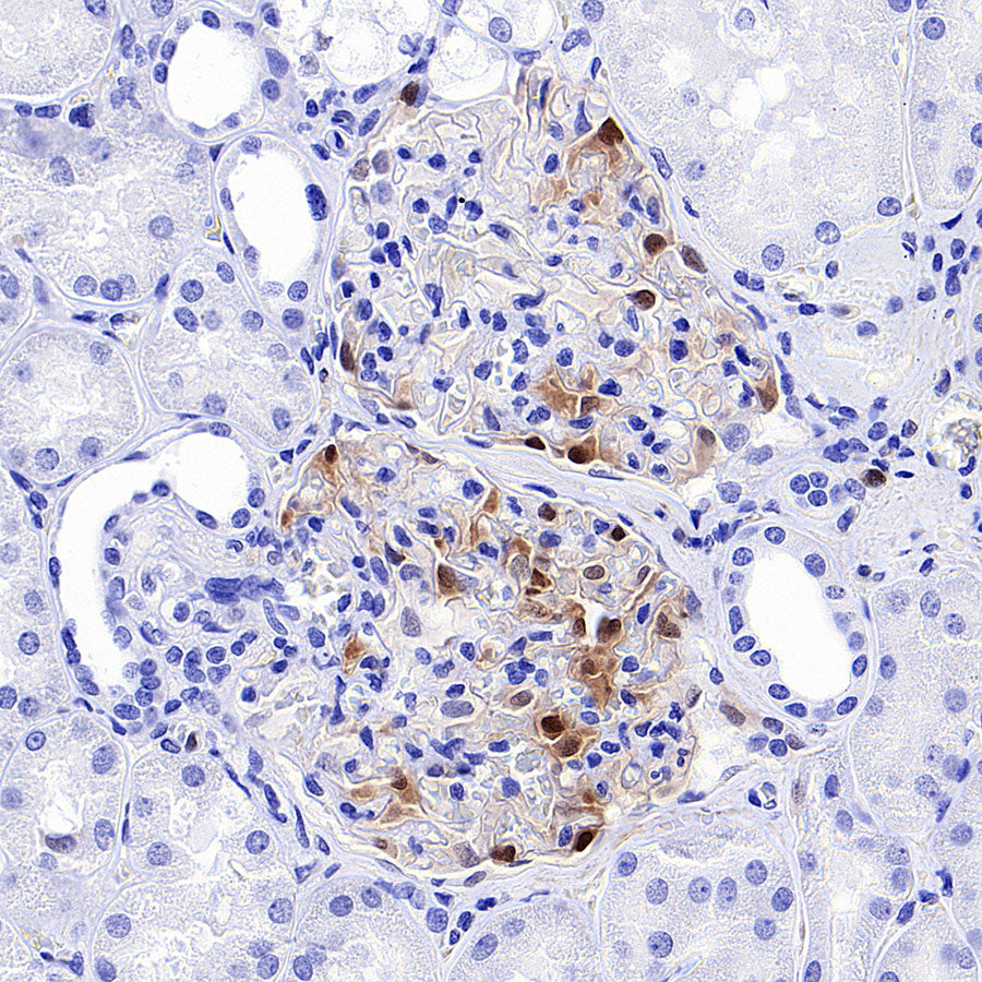 Phospho-p44/42 MAPK (Erk1/2) (Thr202/Tyr204) Recombinant Rabbit mAb (S-5119)