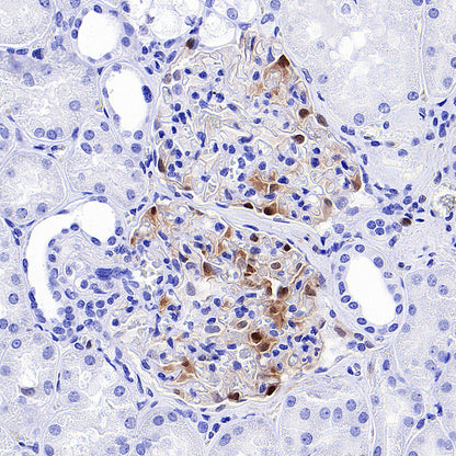 Phospho-p44/42 MAPK (Erk1/2) (Thr202/Tyr204) Recombinant Rabbit mAb (S-5119)