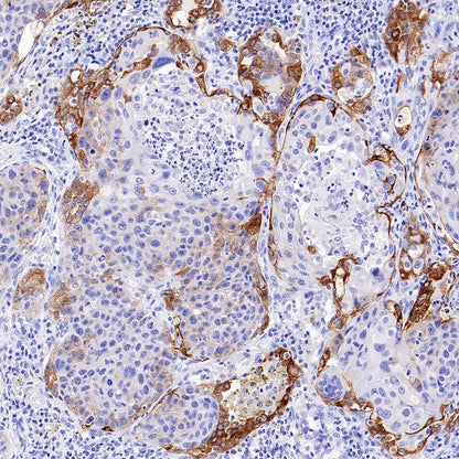 Integrin beta 6 Recombinant Rabbit mAb (SDT-1445-78)