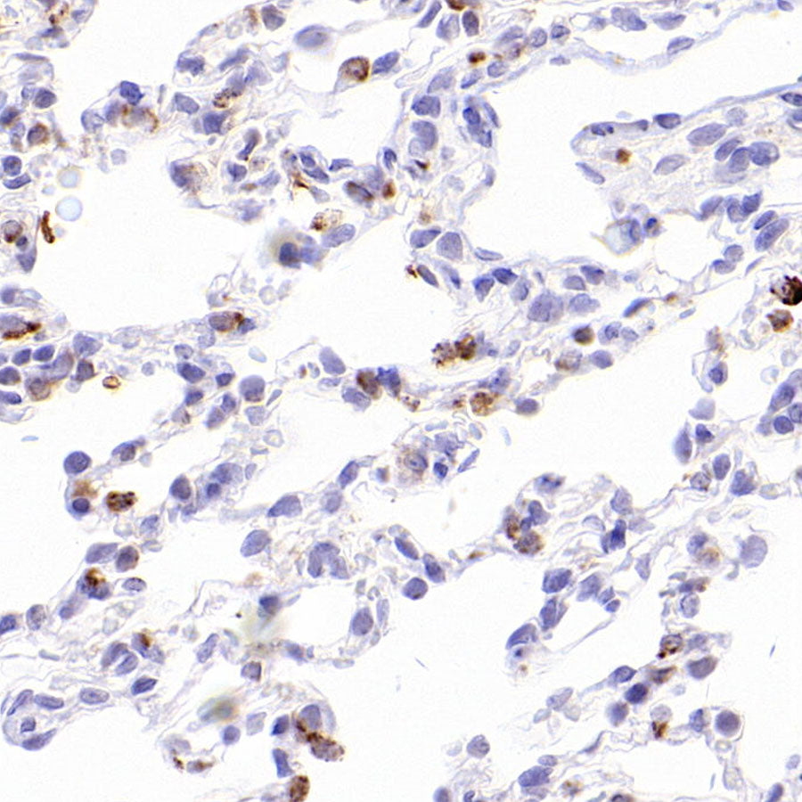 Napsin A Recombinant Mouse mAb,PBS Only (SDT-4204)