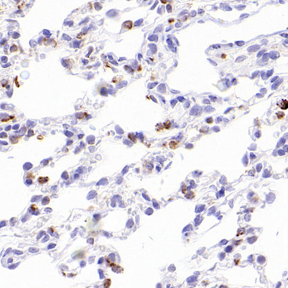 Napsin A Recombinant Mouse mAb,PBS Only (SDT-4204)