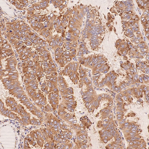 ERAP1 Recombinant Rabbit mAb (S-2509-38)