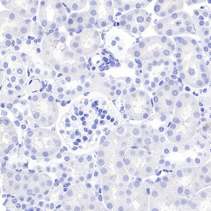 FABP7 Recombinant Rabbit mAb (S-762-114)