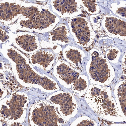 MEK1/2 Recombinant Rabbit mAb (S-834-101)