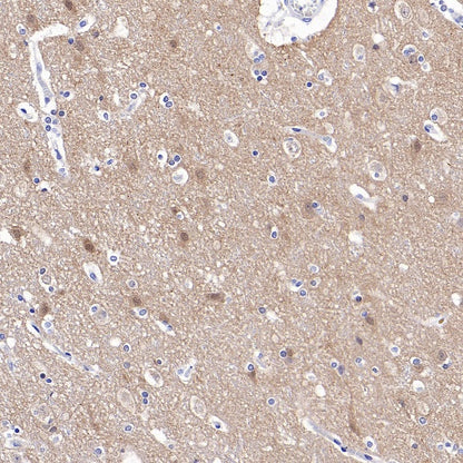 Rab11 Recombinant Rabbit mAb (S-1601-68)