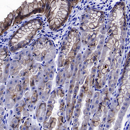 RAB27A Mouse mAb (S-M0050)