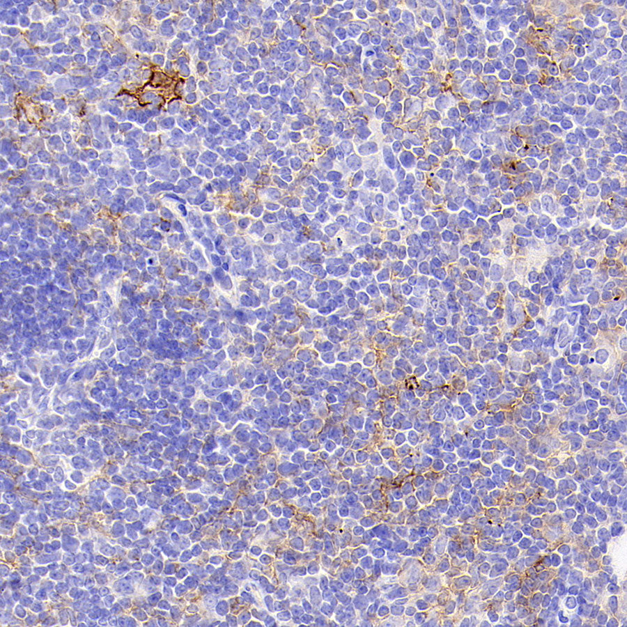 PD-L1 Recombinant Rabbit mAb (S-3933-78)