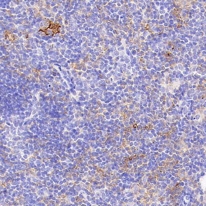 PD-L1 Recombinant Rabbit mAb (S-3933-78)