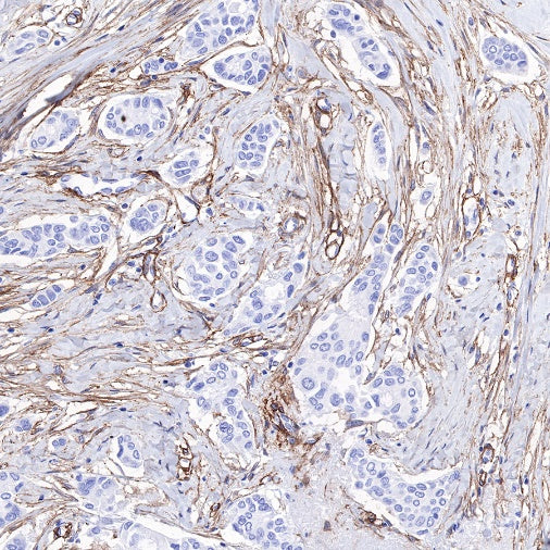 PDGFRA+PDGFRB Recombinant Rabbit mAb (S-393-11)