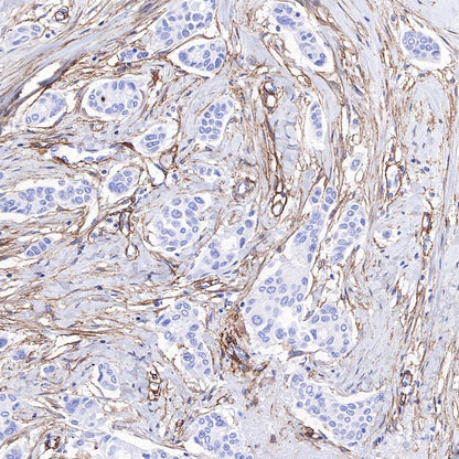 PDGFRA+PDGFRB Recombinant Rabbit mAb (S-393-11)