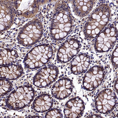 Atg3 Recombinant Rabbit mAb (S-2168-20)