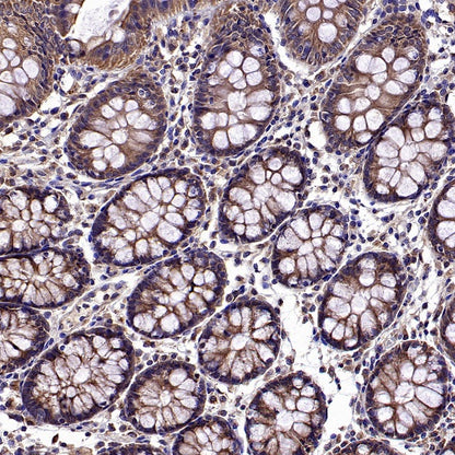Atg3 Recombinant Rabbit mAb (S-2168-20)