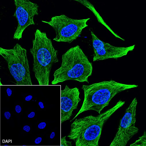 α/β-Tubulin Antibody Rabbit Polyclonal Antibody