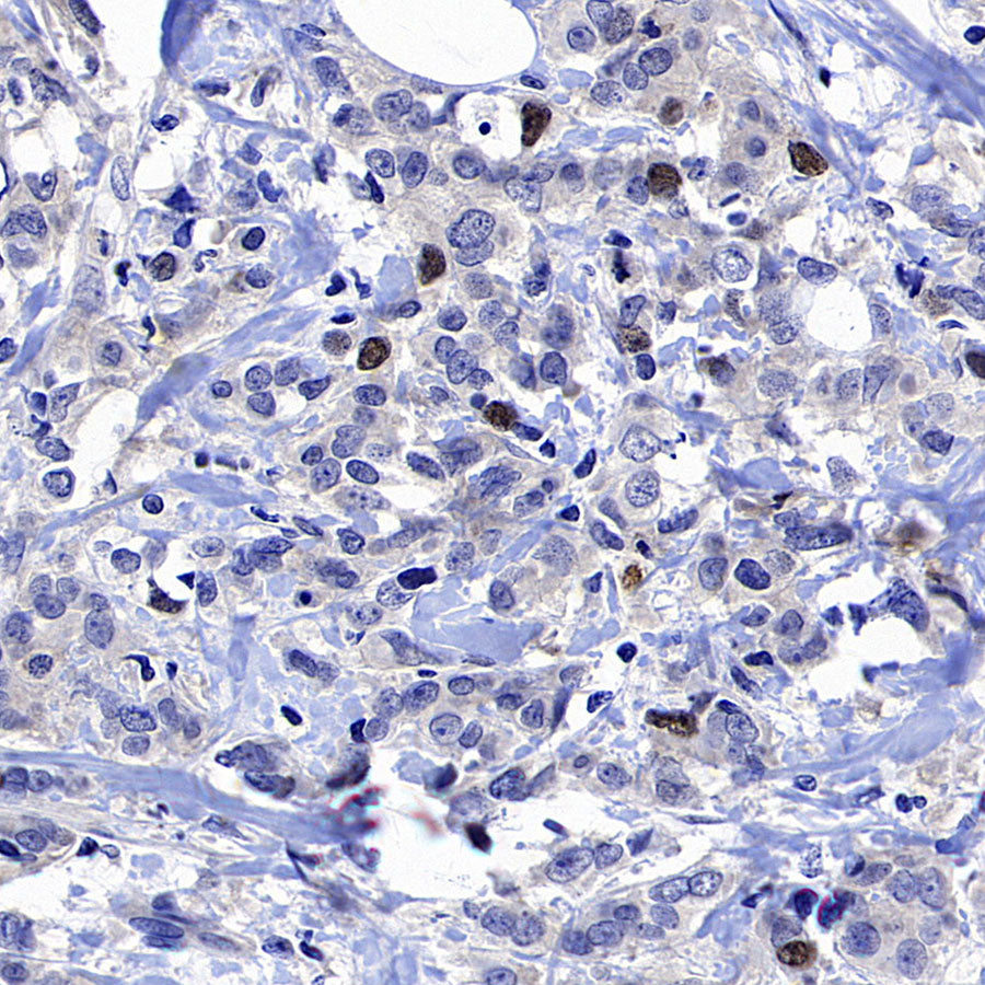 CENP-F Recombinant Rabbit mAb (S-3148-75)