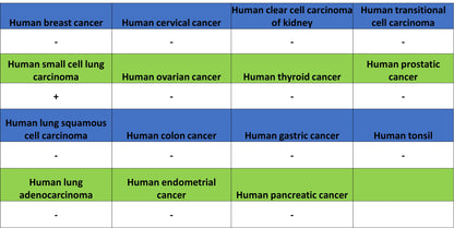 NeuroD1 Recombinant Rabbit mAb (SDT-3843-59)