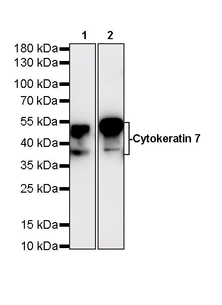 Cytokeratin 7 Recombinant Rabbit mAb (S-5954)
