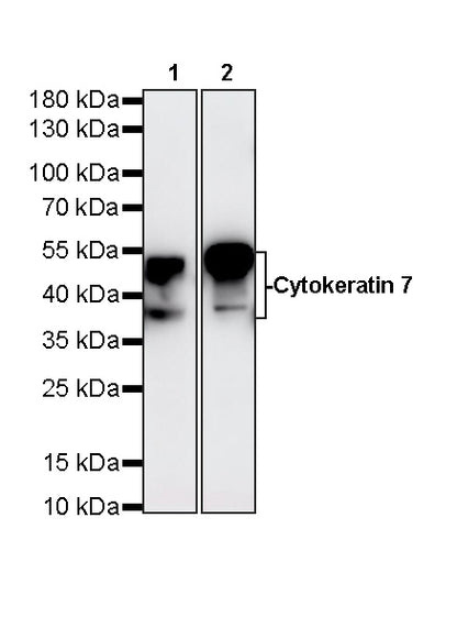 Cytokeratin 7 Recombinant Rabbit mAb (S-5954)
