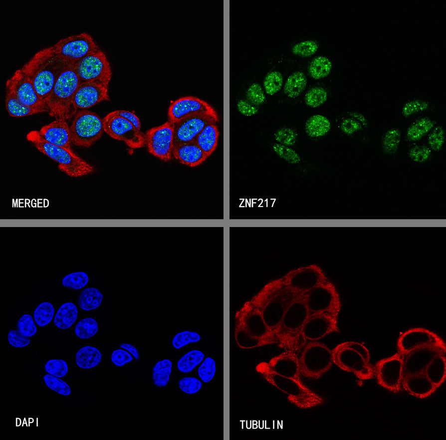 ZNF217 Recombinant Rabbit mAb (S-4699-14)