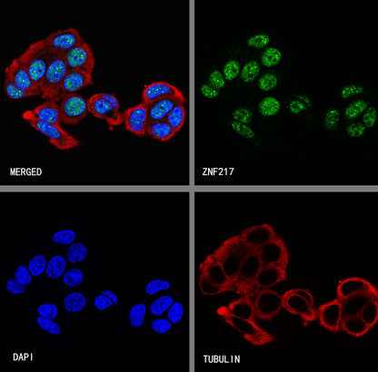 ZNF217 Recombinant Rabbit mAb (S-4699-14)