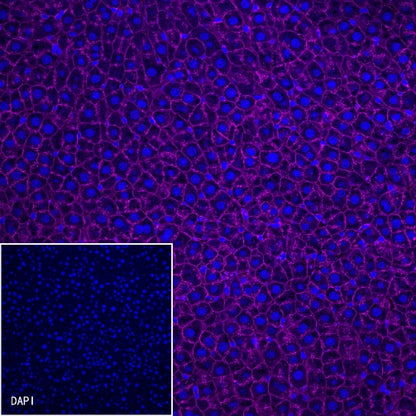 β-Catenin Recombinant Rabbit mAb (Cy5 Conjugate) (S-336-23)