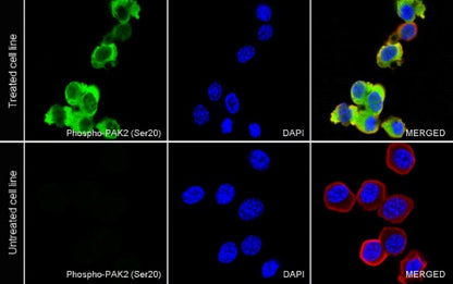 Phospho-PAK2 (Ser20) Recombinant Rabbit mAb (S-507-231)