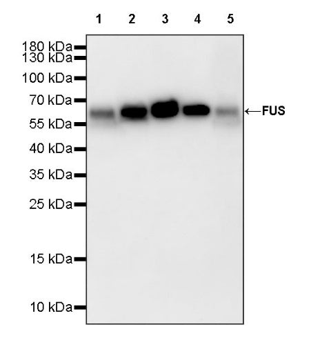 FUS Recombinant Rabbit mAb (S-1015-21)