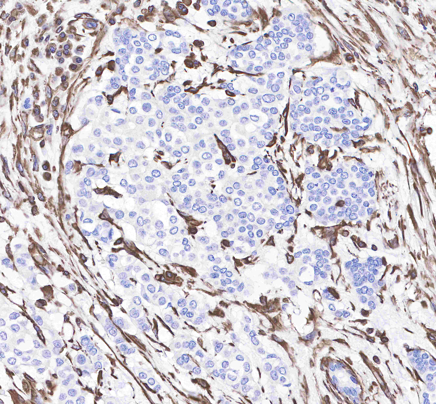 OneStep polymer HRP Goat anti Rabbit IgG(H+L) (specific for IHC)