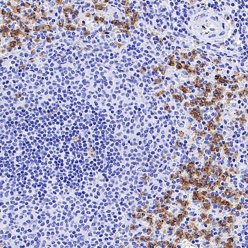 CD88 Recombinant Rabbit mAb (S-1921-43)