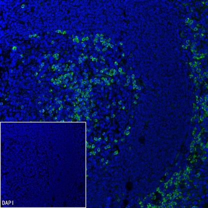 Sec61B Recombinant Rabbit mAb (S-4499-3)
