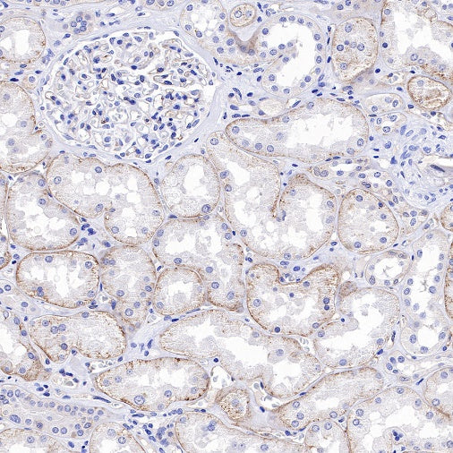 CD49f Recombinant Rabbit mAb (S-1019-73)