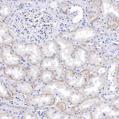 CD49f Recombinant Rabbit mAb (S-1019-73)