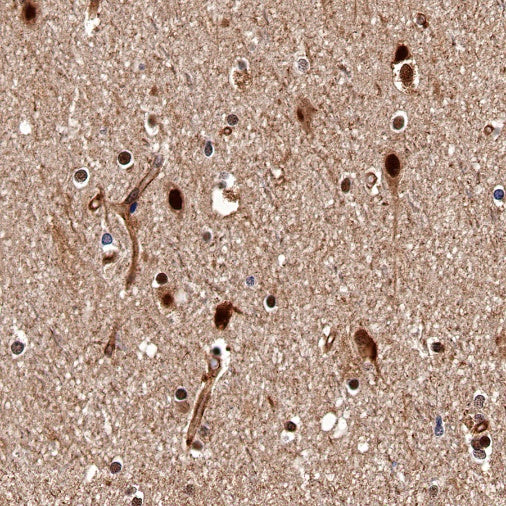 DYNLL1/PIN Recombinant Rabbit mAb (S-1460-8)