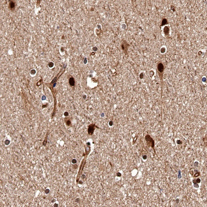 DYNLL1/PIN Recombinant Rabbit mAb (S-1460-8)