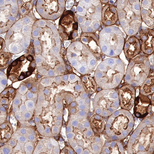 Non-muscle Myosin IIB/MYH10 Recombinant Rabbit mAb (S-299-3)