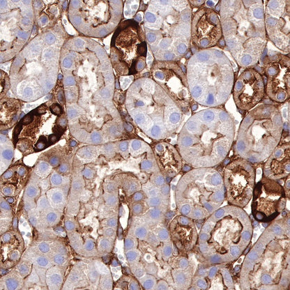 Non-muscle Myosin IIB/MYH10 Recombinant Rabbit mAb (S-299-3)