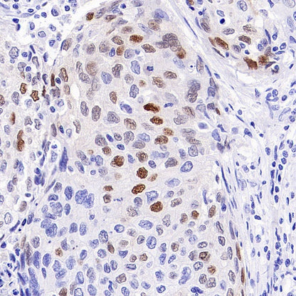 p21 Waf1/Cip1 Recombinant Rabbit mAb (SDT-1349-71)