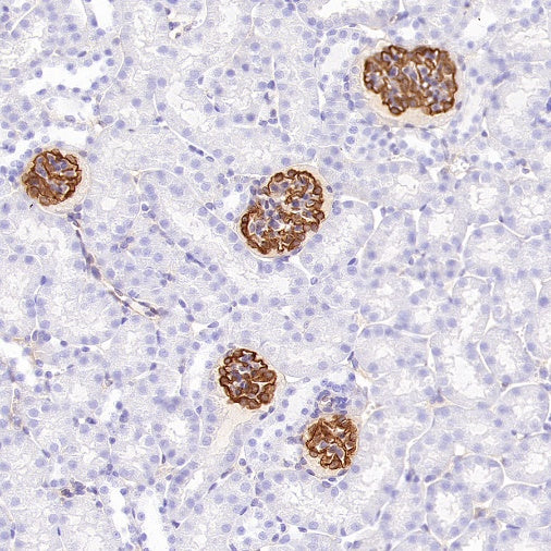 Synaptopodin Recombinant Rabbit mAb (SDT-3331-4)